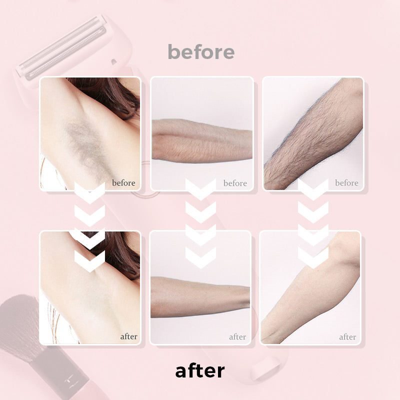 💞40% OFF 💞 Épilateur polyvalent